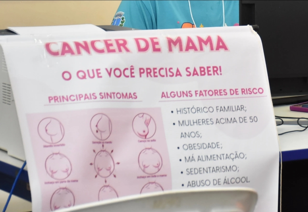 Prefeitura de Botucatu intensifica ações de prevenção com Papanicolau e agendamento de mamografias